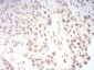 TERT Antibody